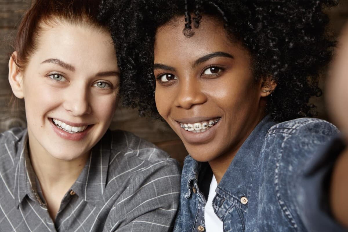 Dynaflex Norris Passive Self-Ligating Bracket System Now Available Exclusively at Seacoast Braces Miller Orthodontics in Dover and Exeter, NH