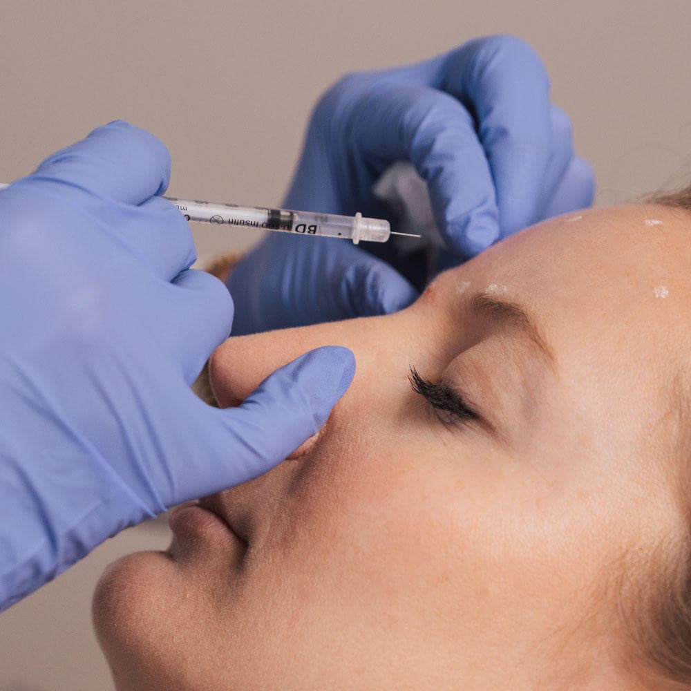 Botox in Corte Madera: More Than Just Wrinkle Reduction, Expert Care at Laser Center of Marin